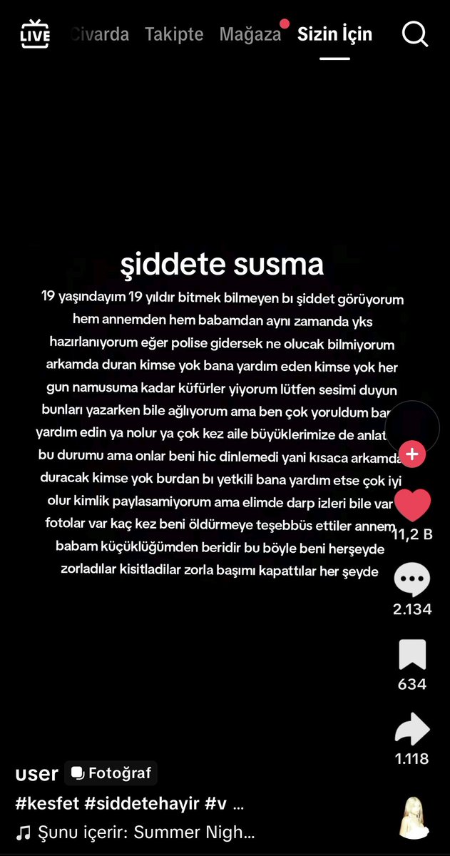0_azraa__'s tweet photo. @zeyno_citlembik Şunu gördün mü https://t.co/0bCHVe9eyi