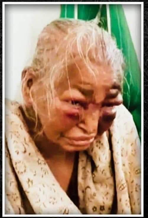 TheForcesGuy's tweet photo. @KirtiAzaad Mone achhe? Aeta ke bole poll violence that @AITCofficial did to BJP Caders. Dim chhoore marle maanush morena! https://t.co/y85wBfogxa