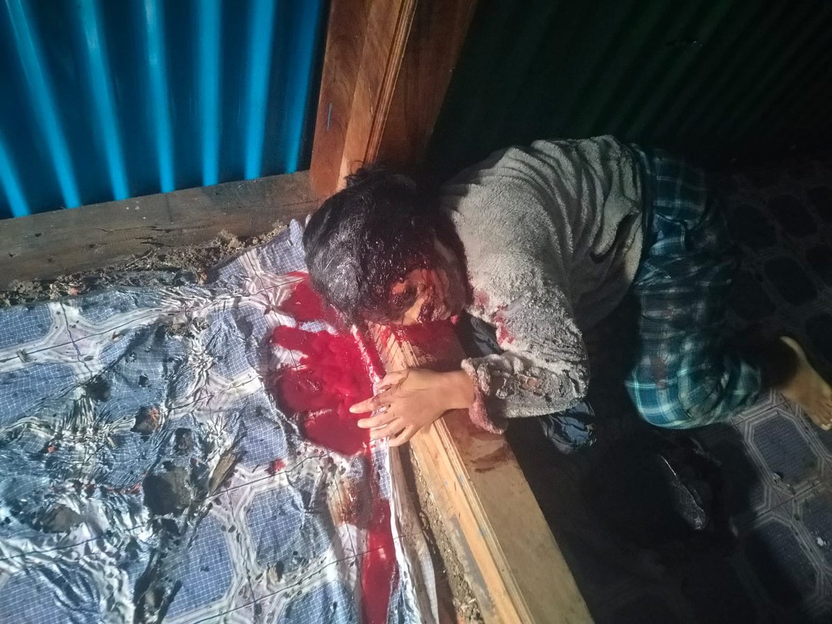 NickgouH's tweet photo. Strong Condemnation of the Attack on #Loibol Khulen Village

We strongly condemn the brutal attack carried out in Loibol Khulen Kuki Village under Bungte Chiru Sub-Division, Kangpokpi District, in the early hours of this morning by suspected ZUF-K militants. This senseless act of violence has claimed the lives of three innocent villagers, including an elderly woman, and left seven homes reduced to ashes.

The killing of innocent civilians and the destruction of their homes is an inhumane act that violates every principle of humanity and justice. Families who were peacefully living in their village have now been left devastated, grieving the loss of their loved ones and struggling to cope with the destruction of their properties.

We call upon the Government of India, the Government of Manipur, and all concerned security agencies to immediately investigate this heinous incident, bring the perpetrators to justice, and ensure the safety and security of vulnerable villages. The lives of innocent civilians must never become targets of armed violence.

Our thoughts and prayers are with the bereaved families who have lost their loved ones in this tragic attack. We stand in solidarity with the people of Loibol Khulen and demand justice for the victims. Those responsible must be identified, arrested, and punished according to the law.

Violence against innocent civilians can never be justified. Peace, security, and justice must prevail.
#Manipur
@adgpi
@Spearcorps
@aajtak
@ZeeNews
@indiatvnews
@DDNewslive
@ndtvindia
@NewsNation
@RepublicBhart
@ANI
@ABPNew
@PTI_News
@airnewsalert
@BBCIndia
@TimesNow
@timesofindia
@ttindia
@the_hindu 
 @IndiaToday
 @WIONews
@majoramitbansal