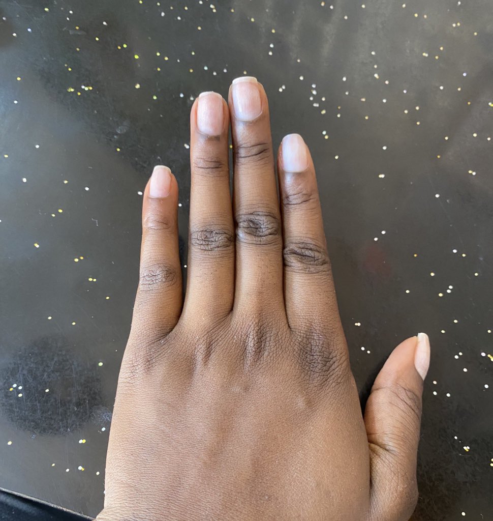 Kusaasirarita's tweet photo. Can I see your natural nails🌝🌝 https://t.co/jLqc4A2LZc