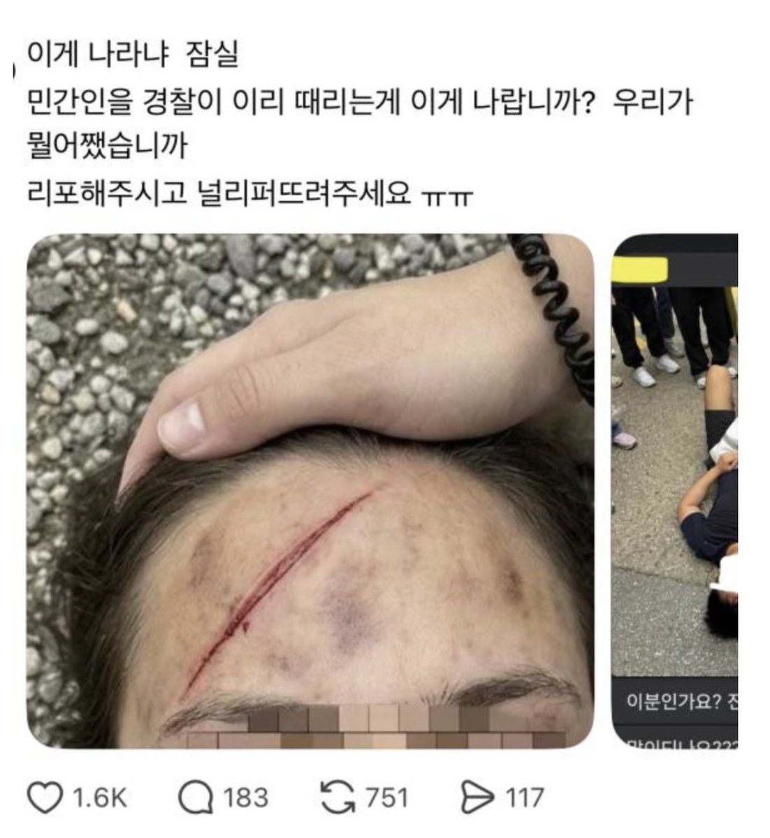 Angksaufrhd's tweet photo. 이재명의 6.5 계엄. 경찰들은 잠실 아파트 주민인 청년의 이마를  무력으로  찢어 놓고, 또 다른 한 명의 시민을 8명의 경찰들이 무력으로 진압. 또 다른 잠실 주민인 청년은 무력하게 투표함을 빼앗겼다고 미안하다 눈물 흘리고 있다 그들은 아무 짓도 안했다. 그저 투표 할 수 있기를 바랐을 뿐임. 7월 부터 모든 표현의 자유는 사라질 예정임.