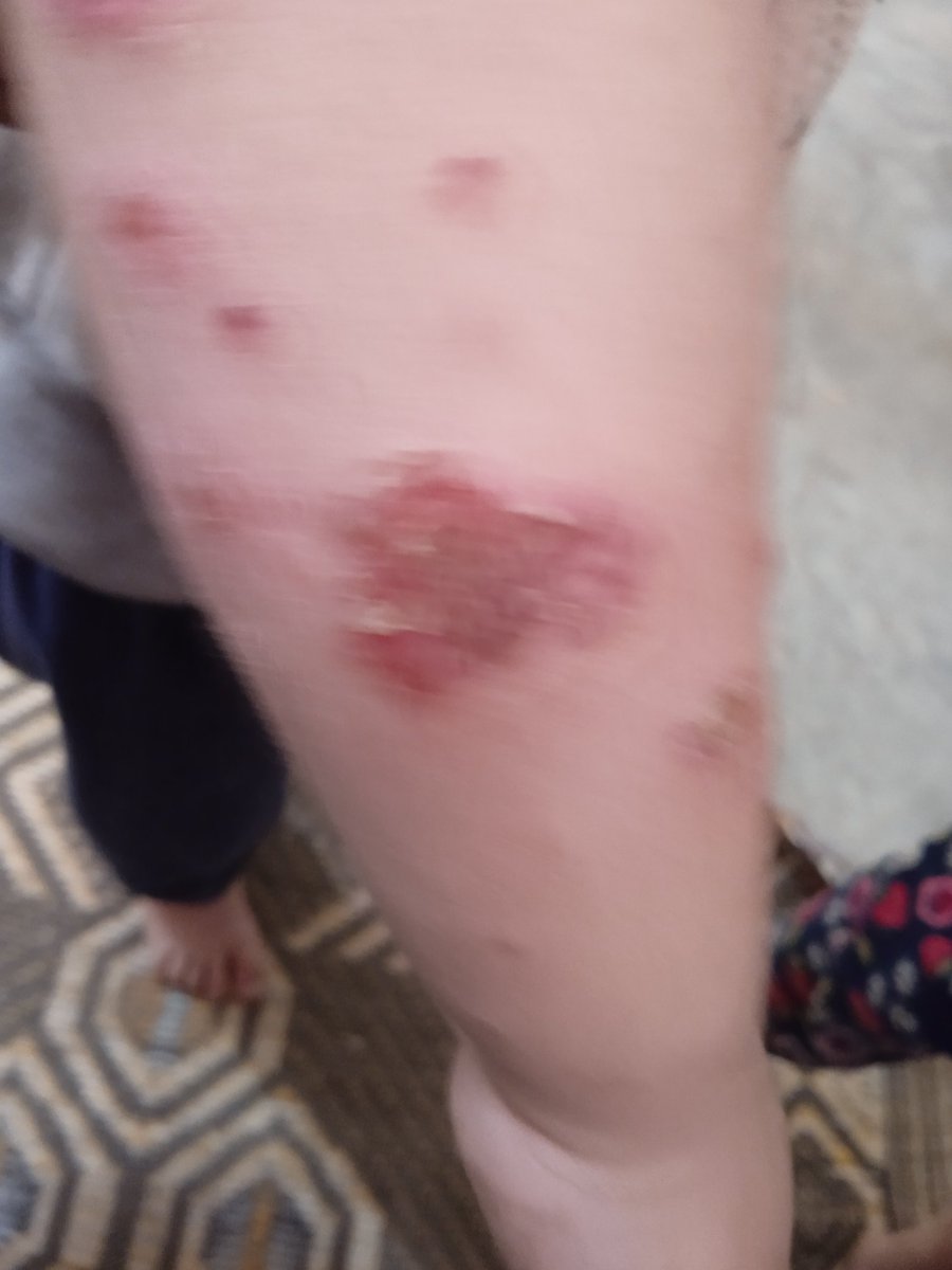 AhmedHe94013122's tweet photo. Please. don't ignore this message. My son needs treatment
My son needs medicine
My son needs clothes
My son needs food
My son needs a chance at life
Please don't ignore this message My son is hungry and fighting for his life. He doesn't deserve this fate 
https://t.co/j8D1e9Ynqe https://t.co/E7EpXJh4ud
