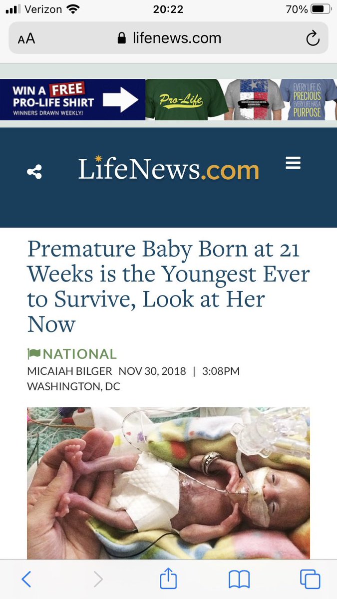 BoundryLayer's tweet photo. @colonelkurtz99 Its disgusting that you don’t think this is human. https://t.co/BkswdgCoPk