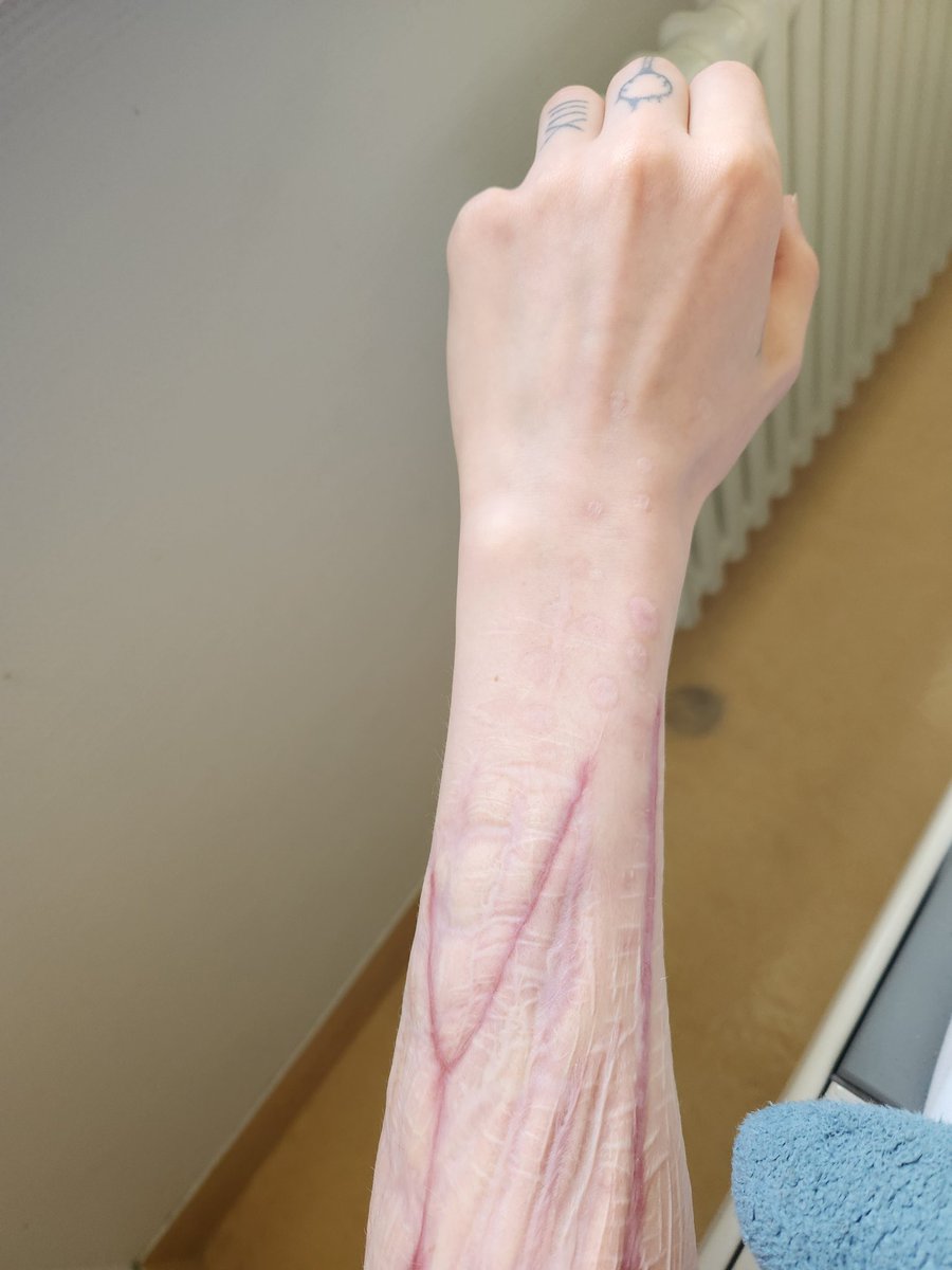XIIIfading's tweet photo. my wrists are pretty much the only part of my body that I actually like https://t.co/G71mmmBEag