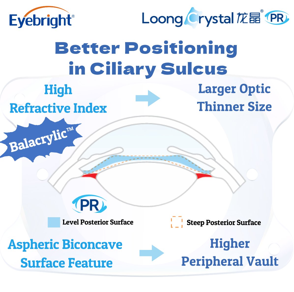 Eyebright2010's tweet photo. Powered by the patented Balacrylic™ material, the Loong Crystal™ phakic refractive intraocular lens achieves ultra-thin dimensions that redefine intraocular positioning. Its revolutionary thinness ensures lower occupancy while allowing better peripheral vault. https://t.co/LwU9lbOgcG