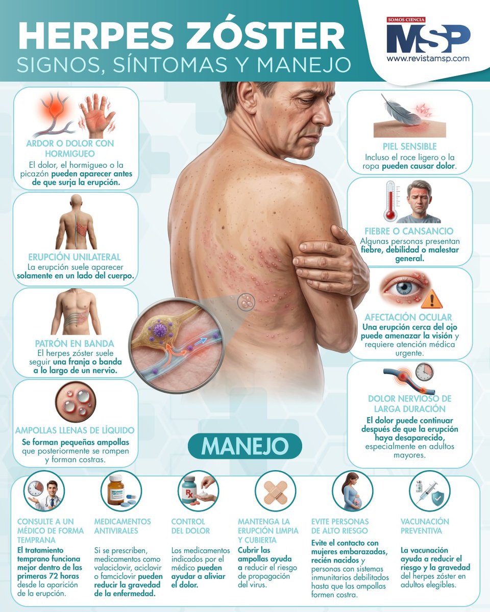 RevistaMSP's tweet photo. #MSPInfectología 🦠 El herpes zóster o “culebrilla” ocurre por la reactivación del virus de la varicela y puede causar dolor intenso y erupciones en la piel. Conoce sus síntomas, riesgos y cómo prevenirlo.
Más información en https://t.co/Bsq3i0IBi5
#SomosCiencia #LiderDigital https://t.co/AinFiWeRjm