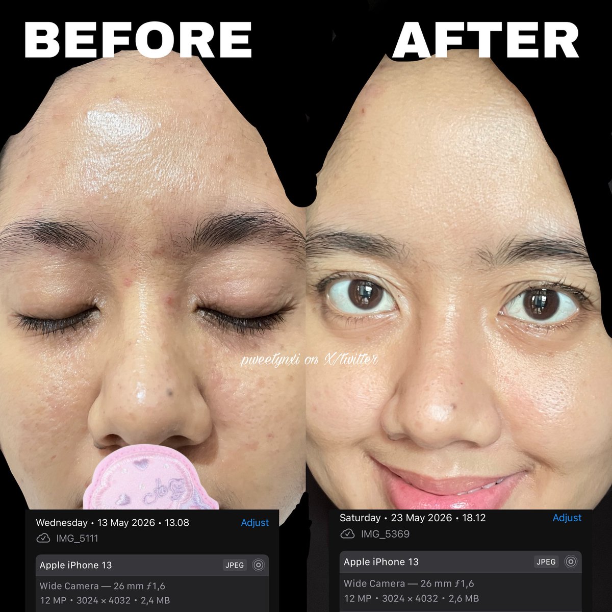 pweetynxi's tweet photo. Malu banget kalo dinotice orang kulitku yang sensitif ini sering bermasalah. Apalagi cuaca panas gini gampang biang keringet, beruntusan, kering, &amp; kemerahan😭🙏🏻

Setelah pake produk bayi better banget alhamdulillah 🥹🧡 https://t.co/Ir3qNfnCPc