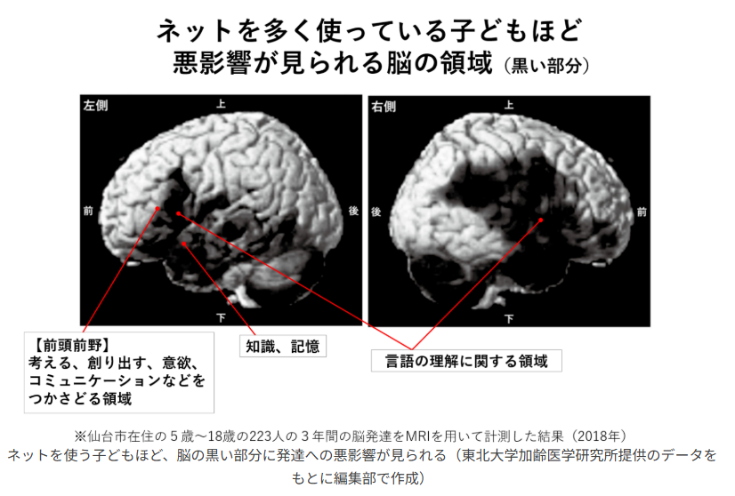 STansuke's tweet photo. 《スマホを使うほど成績は下がる》
『スマホはどこまで脳を壊すか』（朝日新書）より

東北大学応用認知神経科学センターの榊浩平助教は、同大学加齢医学研究所が仙台市教育委員会と共同で行う、市内の小中学生約７万人を対象としたスマホと学習意欲などに関する大規模調査を実施。
書籍にまとめ、その衝撃的な内容が話題になりました。

調査で判明したのは、「スマホの使用時間が長くなるほど成績が下がる」ということでした。
十分な睡眠時間や勉強時間を確保したとしても、スマホを１日３時間以上使っている子どもは、成績が平均点以下であることが明らかになりました。

平均11歳の子ども223人の脳を3年間モニタリングした結果からは、スマホを含むネット漬けの子どもほど、脳の前頭前野という部分を中心に発達への悪影響が出ていることもわかりました。
前頭前野は、考える、覚える、理解するといった知的活動に関する機能のほか、言葉を話す、相手の気持ちを推し量る、感情を制御するといったコミュニケーションに不可欠な機能などをつかさどる、脳の大切な部位です。10代はこの前頭前野の成長期にあたり、その間にスマホを使い続けることは大きな悪影響を及ぼすのです。
https://t.co/pPP2uDmsMt