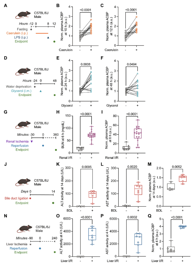 cddpress's tweet photo. “Cell death–induced release of the pro-aging protein acyl CoA binding protein (ACBP) into the circulation”

ACBP/DBI as a systemic biomarker of cell death and organ injury in humans and mice across multiple disease contexts and experimental models ⤵️
https://t.co/dhmMIWSO7k https://t.co/4qnUpGHeph