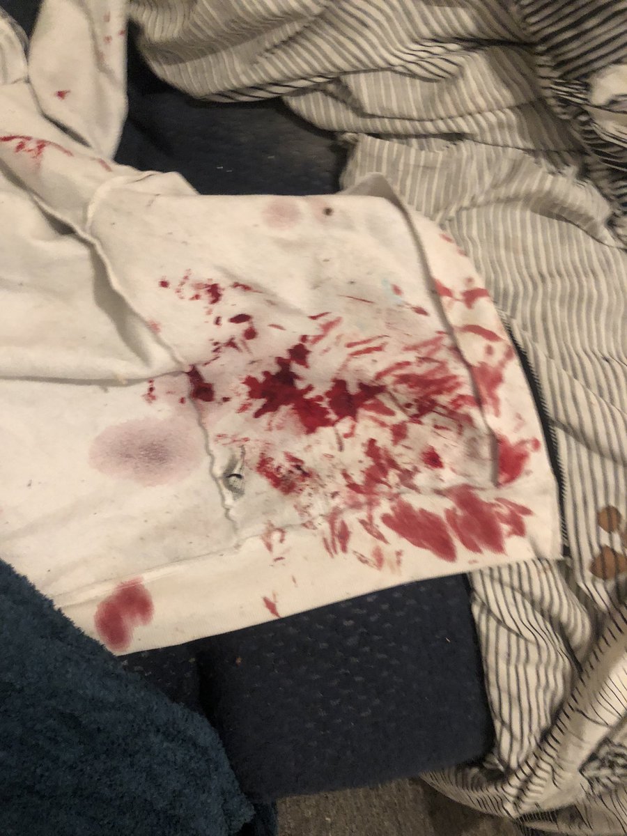 astroscumslave's tweet photo. Is cute so cute||all SFX makeup|| fake|| #shedtwt #shrwt #goretwt https://t.co/Zgf6eciEo9