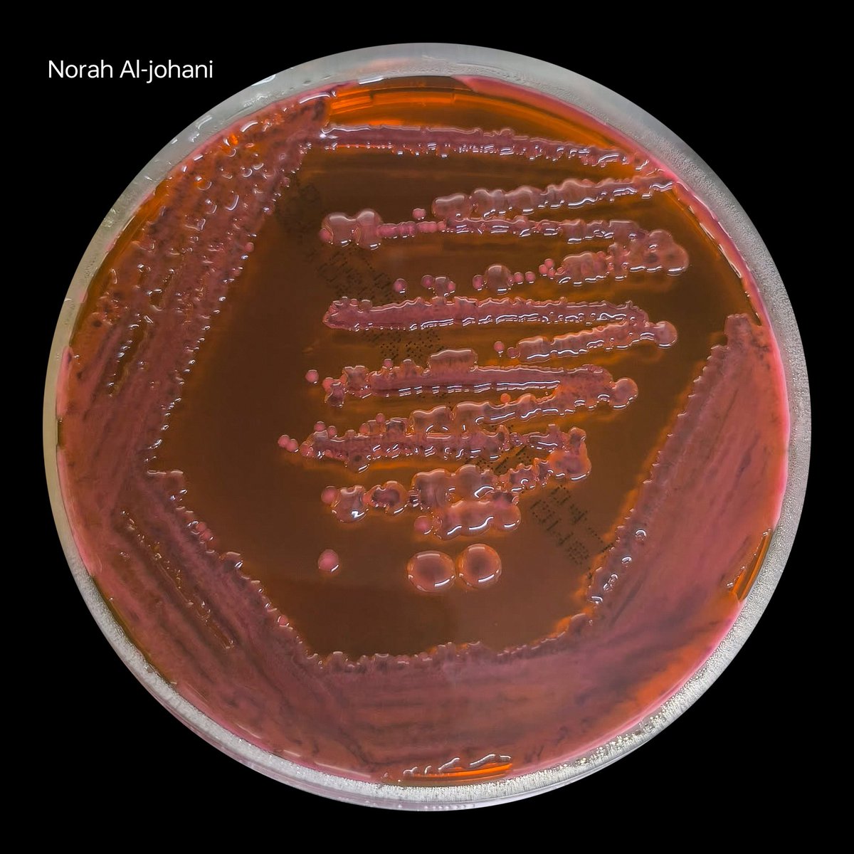 MicrobioGirl's tweet photo. Aesthetics of Klebsiella pneumoniae ❤️🧫 https://t.co/emGA3wvKIr