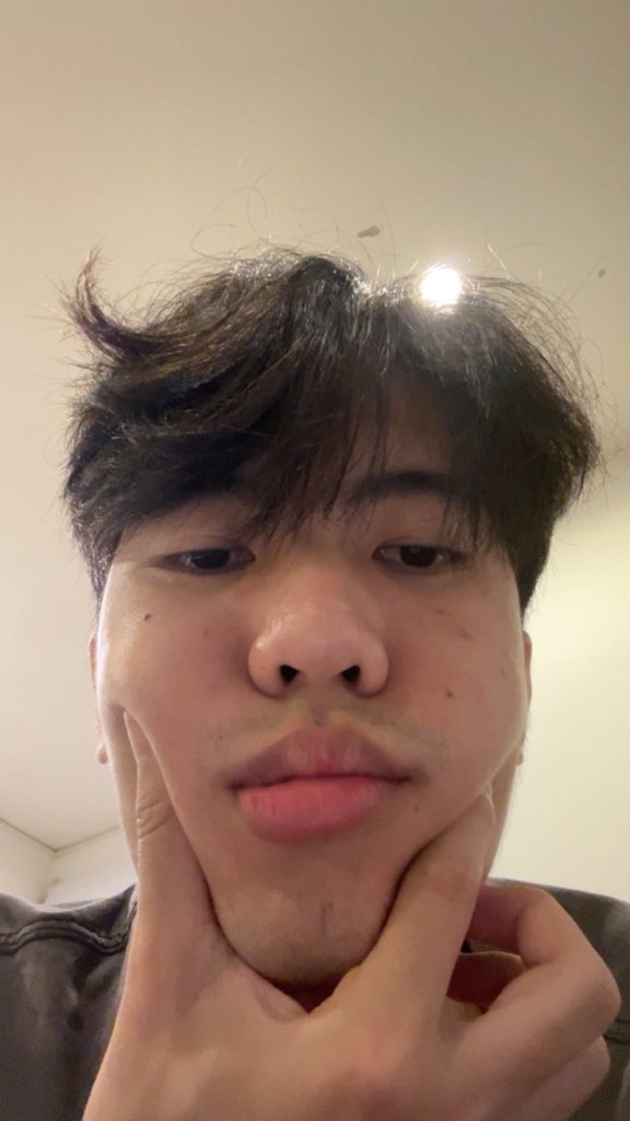 bbxxanp's tweet photo. บวมจริง https://t.co/1pPHaIEW3K