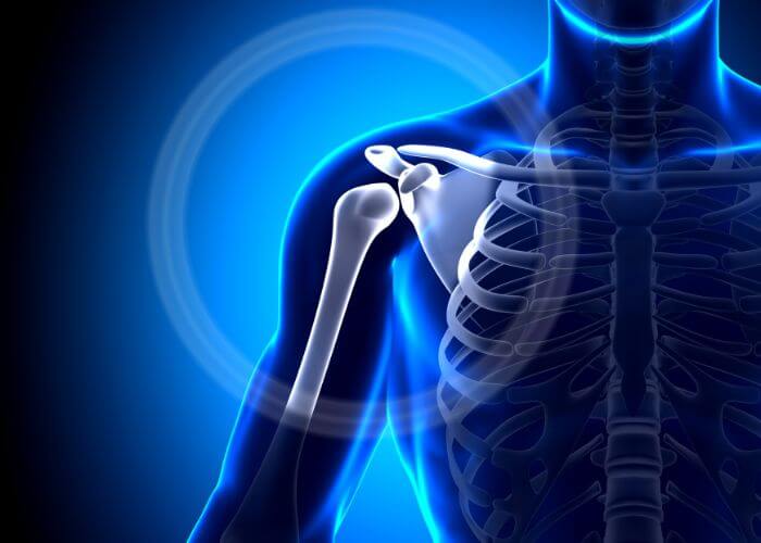 DrJeffPadalecki's tweet photo. #ACjoint separation treatment is grade-dependent.
Mild: sling + rest + rehab.
Severe: surgery to restore stability and prevent chronic shoulder separation.
Reconstruction often includes sutures + coracoclavicular ligament grafting. https://t.co/P8Ye3ww6qu #shoulderseparation https://t.co/1dm1UryNXi