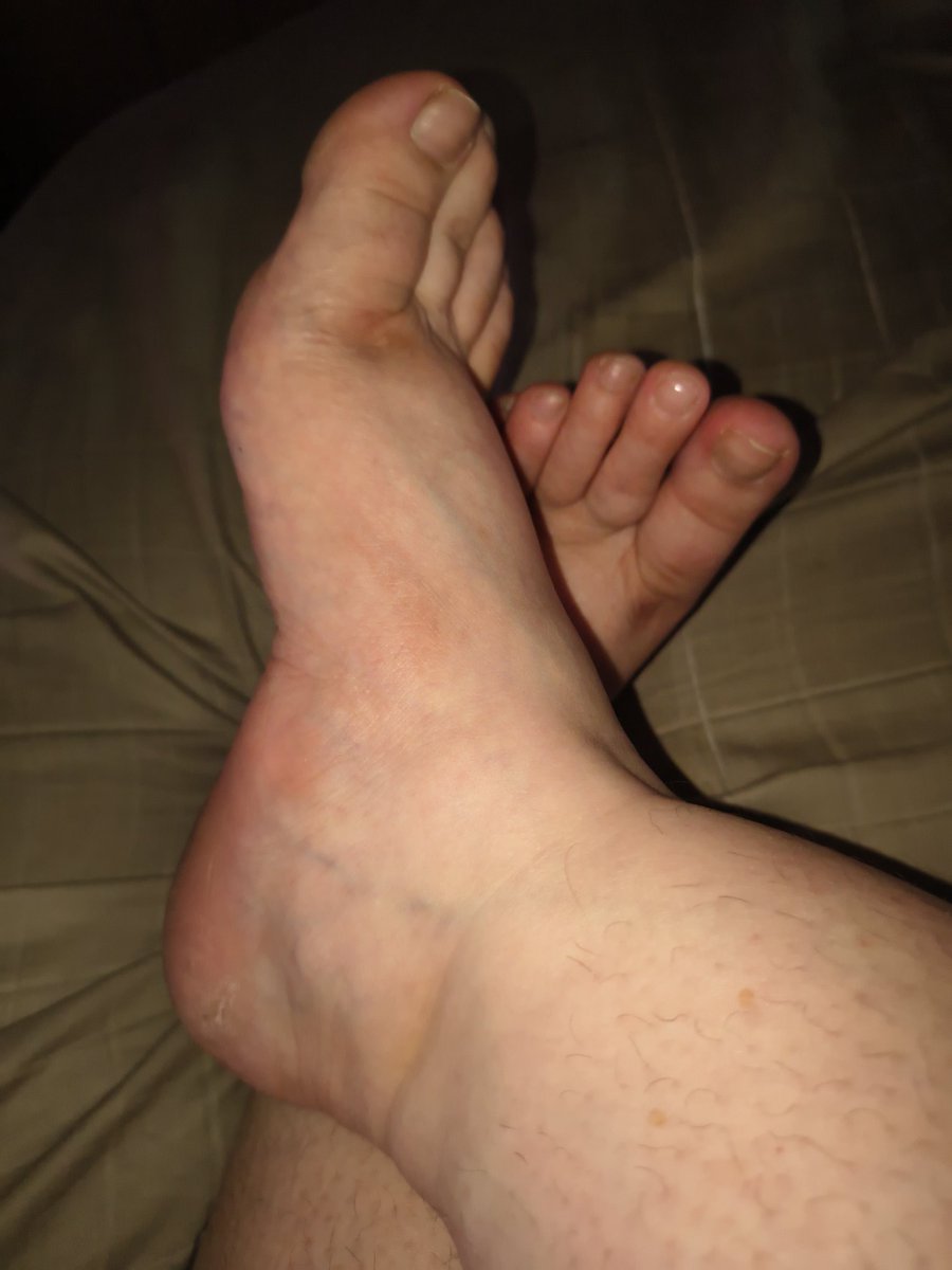 SSourdrop's tweet photo. #feet https://t.co/T1oM91RLCy