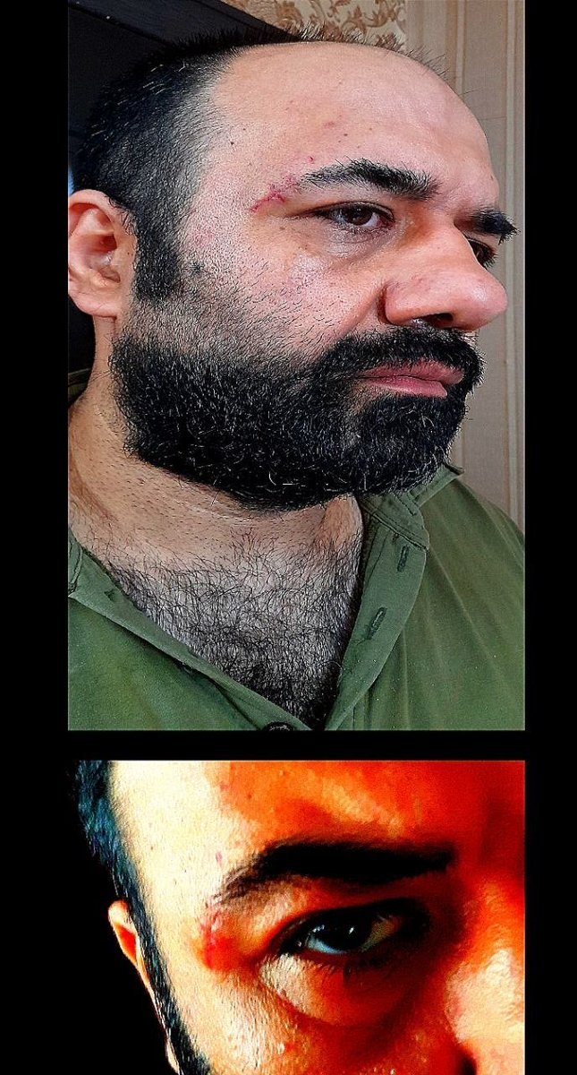 AnarchyFront's tweet photo. @panee_motamedi هشدار !
حاوی صحنه های شکنجه ‌و جراحت بیضه ، پا و صورت سهیل عربی 

#سهیل_عربی
#قزلحصار
توضیحات 👇

منبع . دادخواهان دربند 

https://t.co/WJurABeHAi https://t.co/j1lDnpTFWh