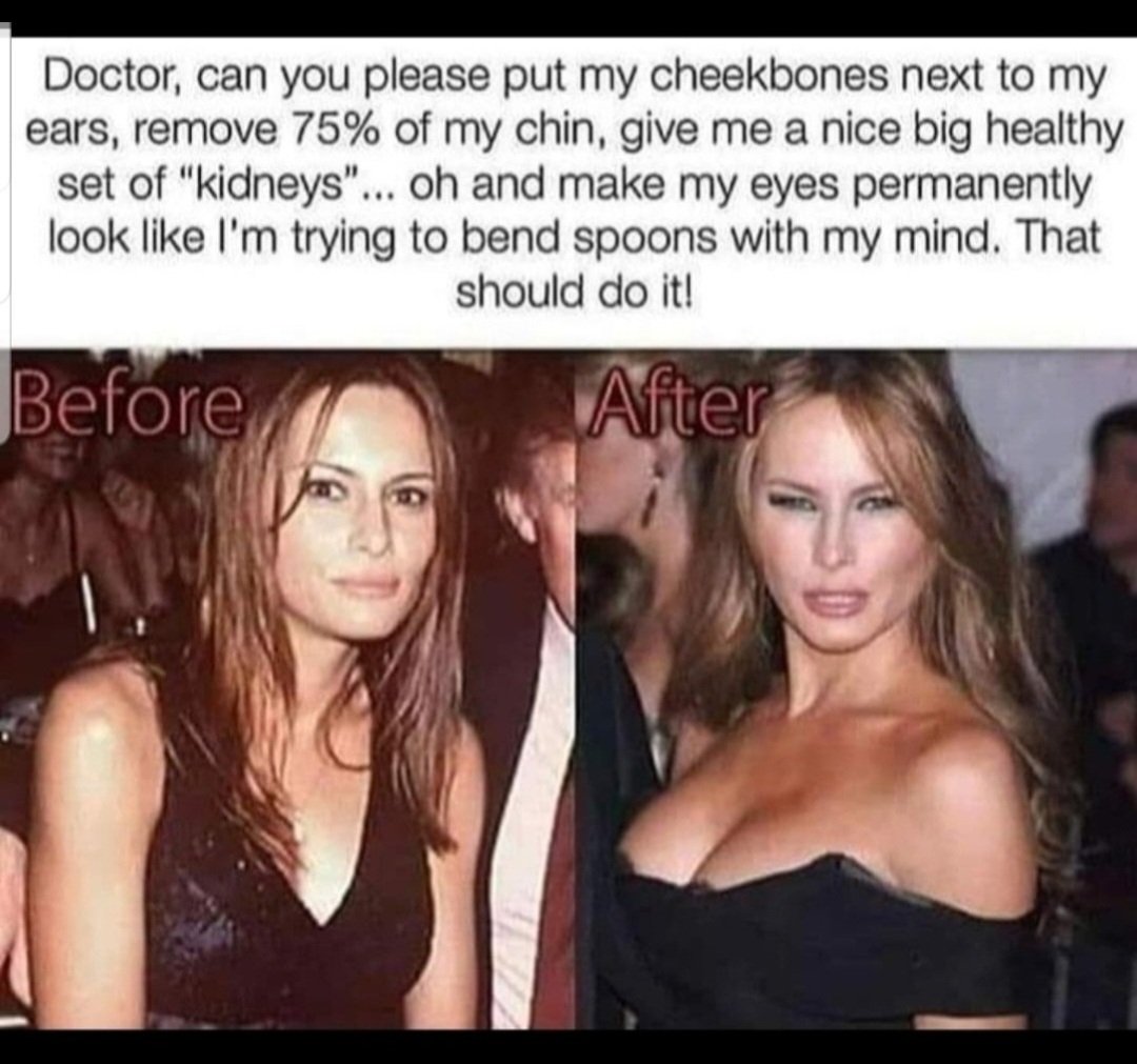 mindylee26's tweet photo. @bluemontanasky @Gianl1974 @knifepoint100 Well, she visited a surgeon and changed a number of her body parts. https://t.co/p7OnYQAimX