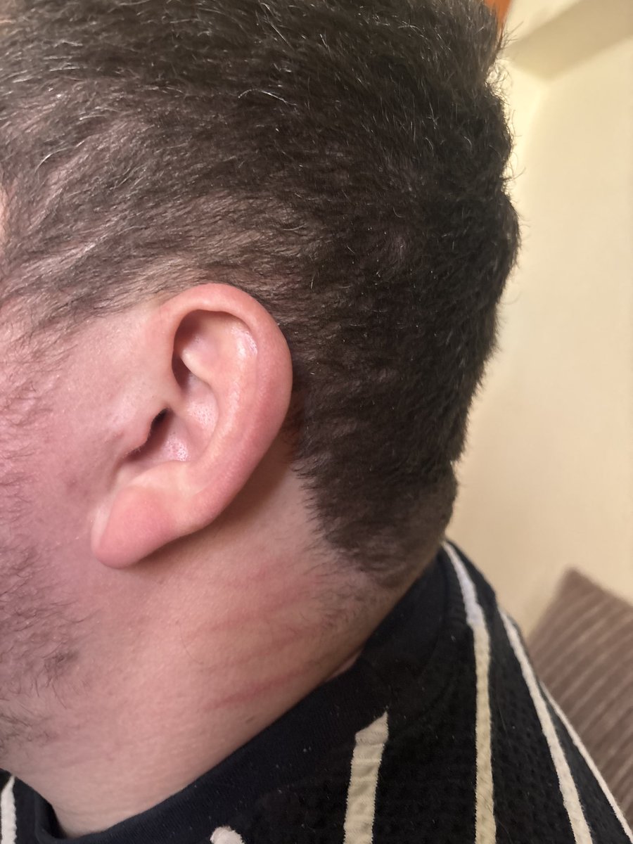 llilaclillyOG's tweet photo. When your rugby playing roommate fucks you so good he’s full of scratches 😮‍💨 https://t.co/axdbCplGOH