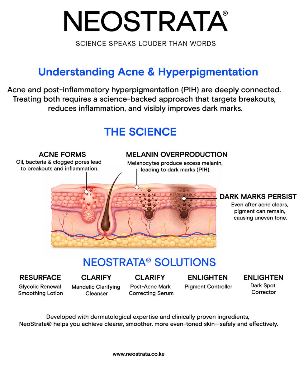 NeostrataEA's tweet photo. Acne doesn't always end when the breakout does.
For many, the real challenge begins after the inflammation settles — when dark marks and uneven tone are left behind. 

#NeoStrata #NeoStrataEA #PIH #PostInflammatoryHyperpigmentation #AcneMarks https://t.co/N7ZgijMBMi