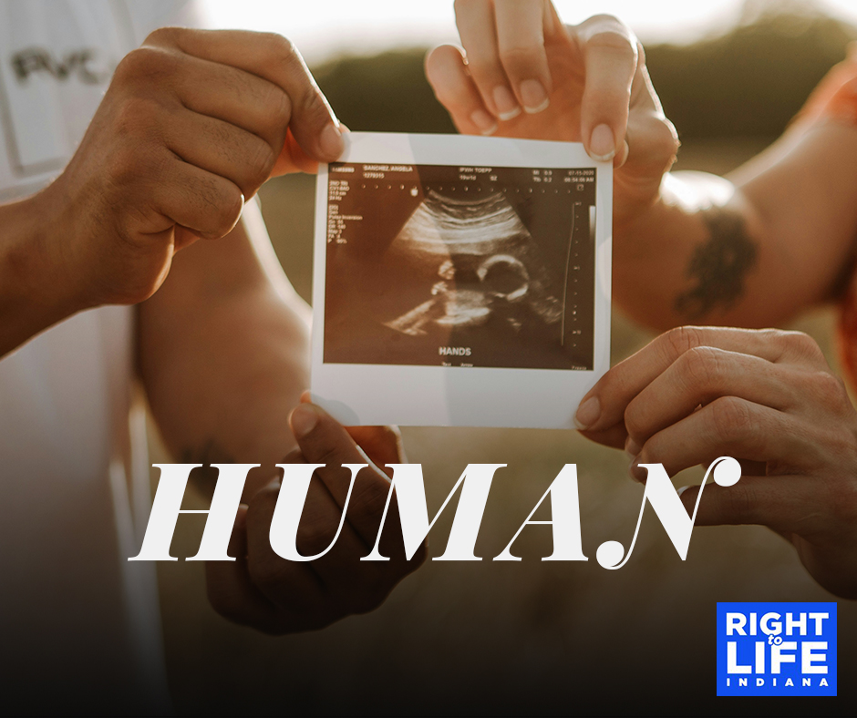 irtl's tweet photo. Protect human LIFE! https://t.co/Yw4wqYyHmp