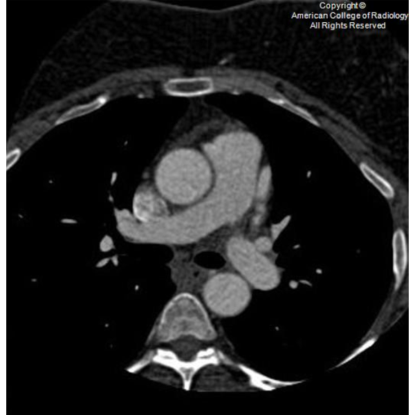 RadiologyACR's tweet photo. A 46-year-old female presents for preoperative evaluation prior to gastric surgery. #ACRCaseinPoint https://t.co/63WH2dPpIZ https://t.co/JKYLaDAZQM