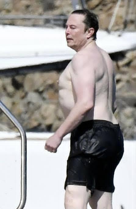 Daddythighmeat's tweet photo. Btw if you think Elon Musk is a genius, take a look at what aromatase deficiency looks like. 

This is what happens when you don’t produce estrogen.

He's replicated this disease by taking test with estrogen blockers, bc he thinks that’s how you become manly. He’s a fucking idiot https://t.co/LVWQsepJ0O