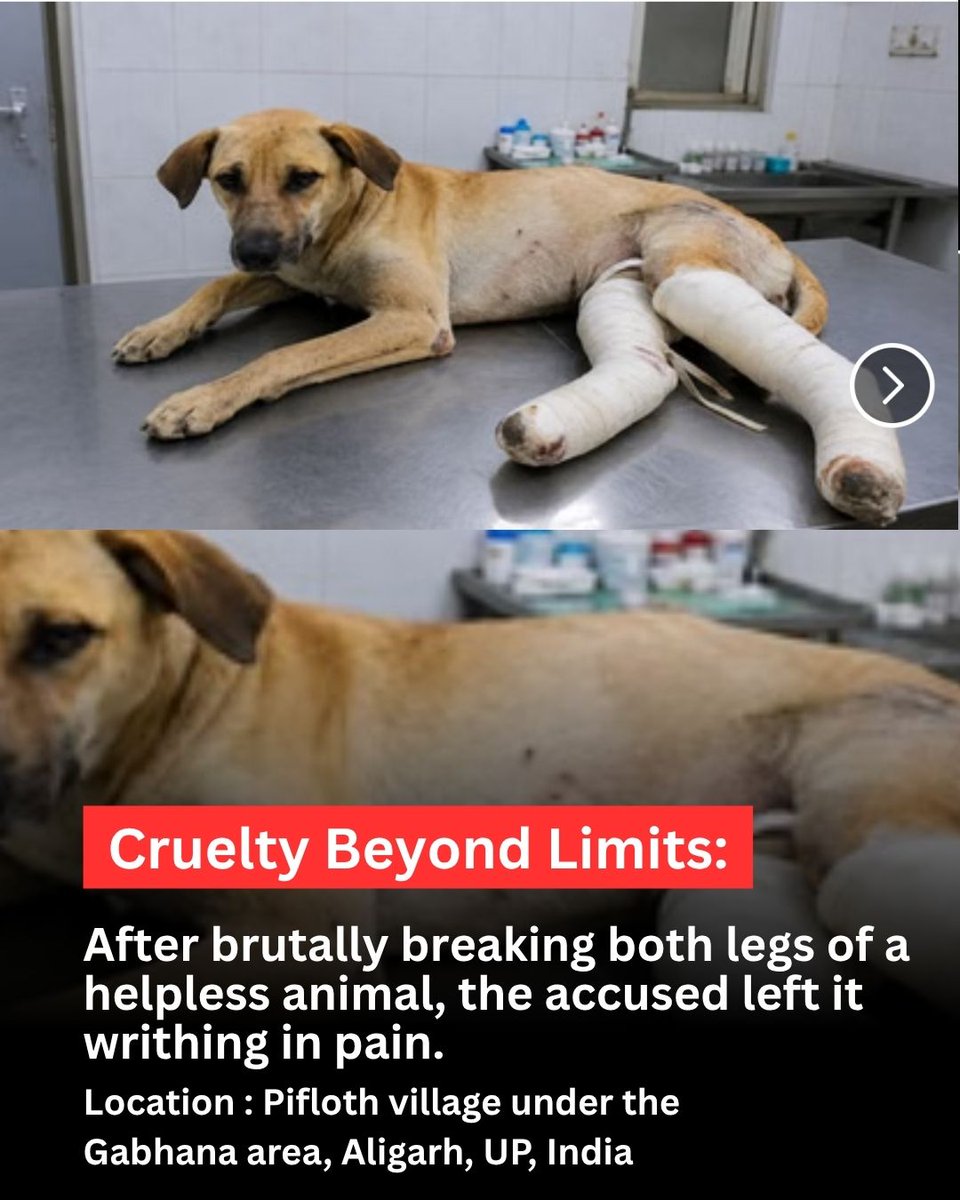 joedelhi's tweet photo. In Aligarh, UP, two men brutally assaulted an Indian breed dog and broke both of her hind legs. 

The severely injured dog was taken to a veterinary hospital for treatment, where she underwent surgery. @RajatSharmaLive @myogiadityanath
@CMOfficeUP

According to reports, on May 13, the female community dog was found in a seriously injured condition in Pifloth village under the Gabhana area, Aligarh, Uttar Pradesh, India.

Both of her hind legs were fractured, leaving her unable to walk or move. 

Upon receiving information about the incident, officials of the Jeev Daya Foundation took her to a veterinarian for treatment. 

Medical examination confirmed severe injuries to both legs, following which surgery was performed.

The Jeev Daya Foundation and PETA India filed complaints with the police and other concerned authorities. Based on the complaint, a case has been registered at Gabhana Police Station against Bablu Jatav and Pappu Jatav under relevant provisions of the Bharatiya Nyaya Sanhita (BNS) and the Prevention of Cruelty to Animals Act.

Animal rights activists have stated that such violence against helpless animals is deeply concerning and that strict action should be taken against those responsible. The injured female dog is currently undergoing treatment, and her condition is reported to be gradually improving.

Local police officials stated that a case has been registered based on the complaint and an investigation is underway. Further action will be taken based on the facts that emerge during the investigation.