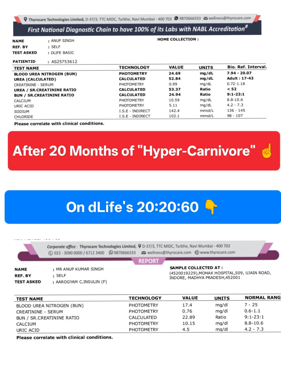 dlifein's tweet photo. 🟢Foundation of dLife's protocol was always data driven
🟢When I speak, I do with data.
🟢Check how KFT nos changed after 20 months of Hypercarnivore (ate only boneless meat, eggs) with average 3 hrs/week in Gym

Anyone who is rational and trusts data over opinions should OBJECT to someone saying -- badh gaya toe kya hua. Be Hypercarnivore.

No.
Unless you test, you track nothing. If you ignore the bad nos you are just AGENDA driven.

Three failed carnivores are now with dLife and we know the downside of Carnivore.

Talk with DATA.
Not with AGENDA or OPINIONS.
Without before/after blood reports -- everything is hogwash.

Will post about how Thyroid numbers also got screwed on "Hyper Carnivore" and shot up to an unbelievable level with ZERO prior history of Hypothyroidism.

I NEVER talk without DATA.
And I always say- Not everyone needs to be a Carnivore and Carnivore is not for everyone. 

So I switched back to 20:20:60 (started in 2011) after this Hypercarnivore shit.