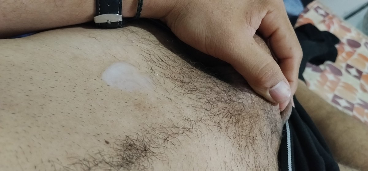 Castrr7891's tweet photo. el colágeno 🥵 https://t.co/sokFVroU3a