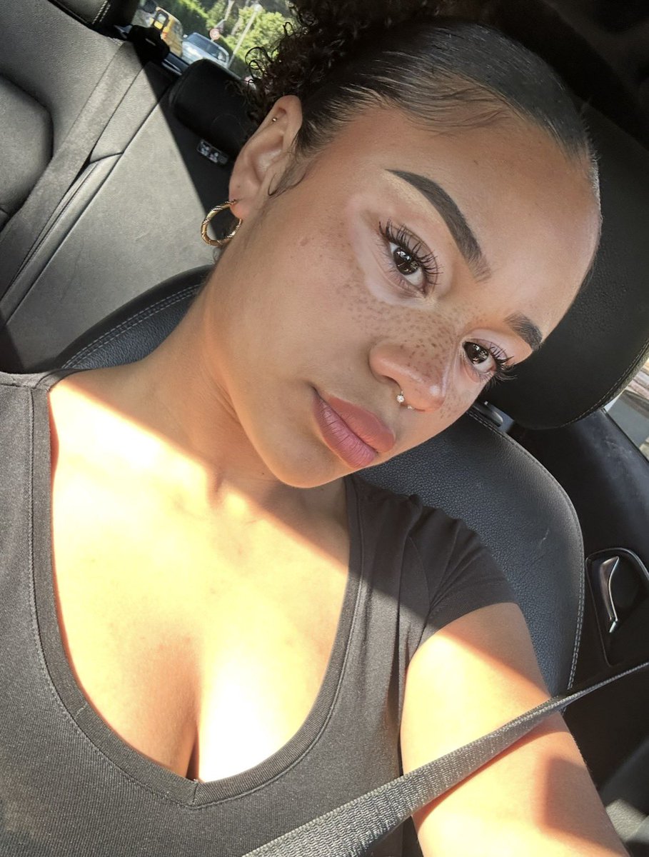 metissetdah's tweet photo. #princessevitiligo
(autour des yeux) https://t.co/p4IG7bozSM