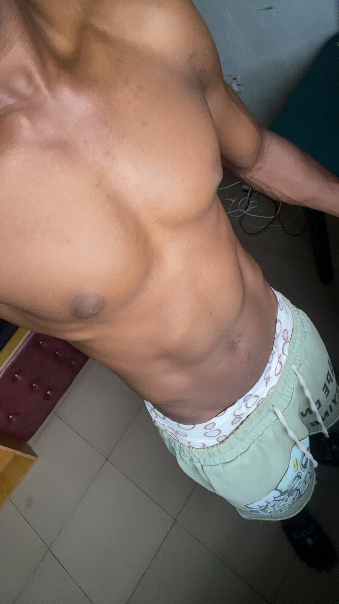 Iyiolar2's tweet photo. @MRKOWALCZYK7 @interesting_aIl Ofcourse we fat as fuck https://t.co/u0zOH9lsqE