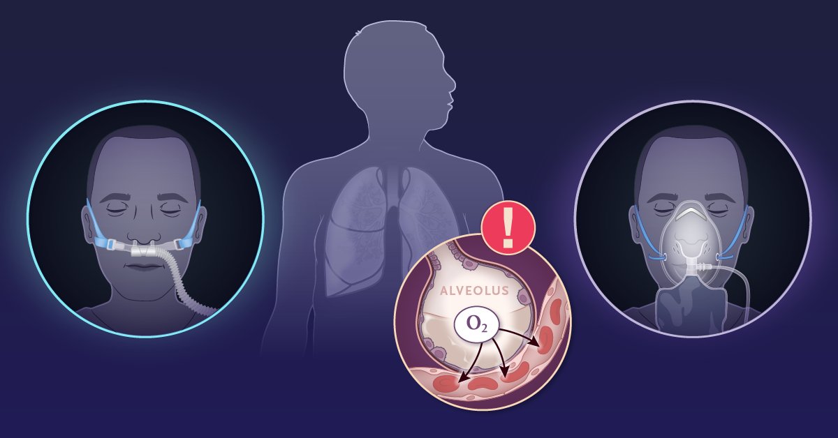 NEJM's tweet photo. For patients with acute hypoxemic respiratory failure, whether high-flow oxygen is superior to standard oxygen in reducing mortality is unclear. Research findings from the SOHO trial are summarized in a new Quick Take video. https://t.co/CdjTWMO61g https://t.co/OEGjqgKmEM