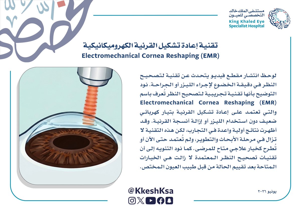 KKESHKSA's tweet photo. تنويه بخصوص تقنية إعادة تشكيل القرنية الكهروميكانيكية

#أنتم_بالعيون https://t.co/51v8jwTGlG