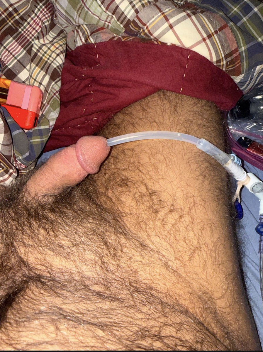 ScWildOne's tweet photo. #foley #catheter #gaykink https://t.co/ExqAqyu6VH