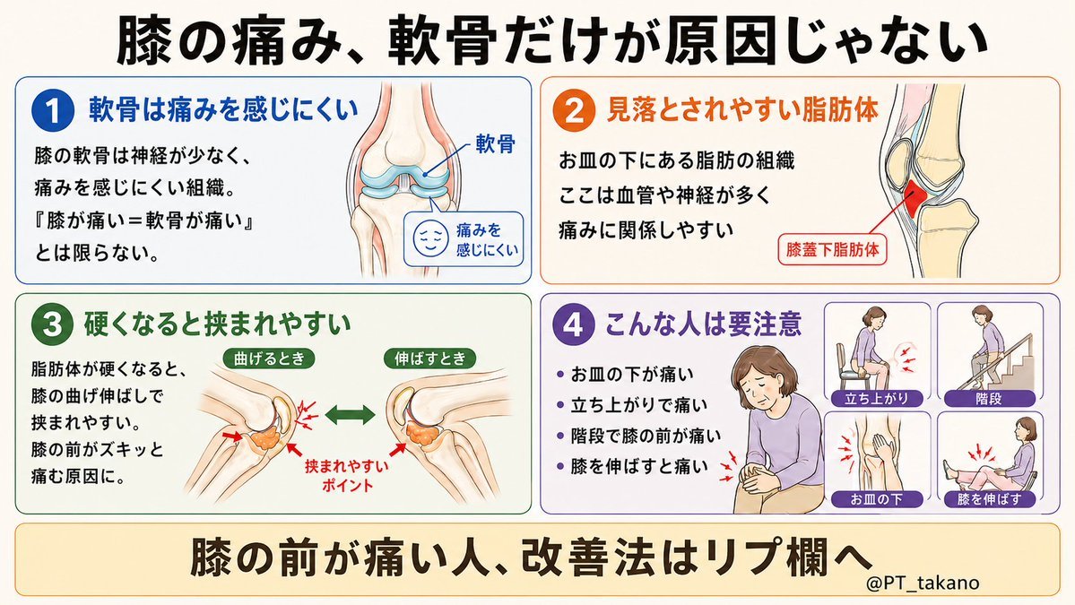 PT_takano's tweet photo. その答えが、
「軟骨じゃなくて脂肪体をほぐせ」だった。

実は、軟骨そのものは痛みを感じにくい組織。
だからここをなんとかする前に、脂肪体が大事。

脂肪体は痛みを感じやすく
ここが硬くなったり、
曲げ伸ばしで挟まれたりすると
ひざの前がズキッと痛みやすい。

おすすめのケア方法は↓ https://t.co/BEJd3dv5j2