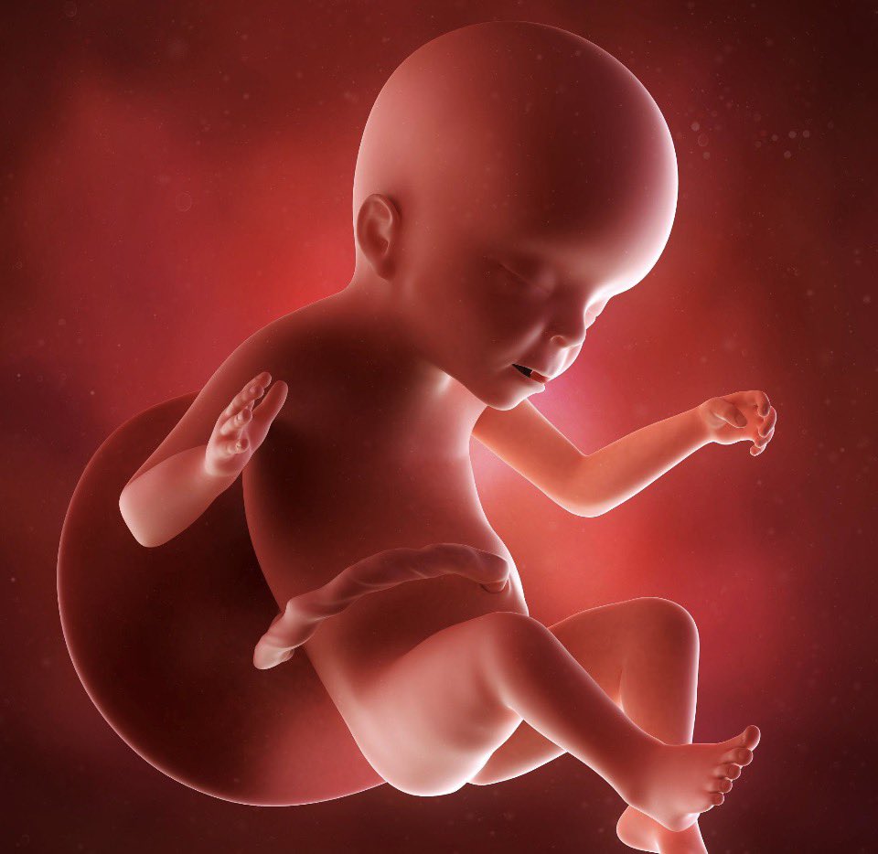 RootsofHealing1's tweet photo. You can not abort your child after you find out (5 months into your pregnancy) that your baby has Down syndrome and then come on the internet and claim the world is bullying you after the “loss” of your child. 
Let’s be clear…
You murdered your baby because they did not fit the idea of what you think a child should be. You killed your child because they did not live up to your expectations. 
One day, you will meet your maker and I hope that you are treated with the same energy that you showed your unborn child that you killed in the womb. This is what your child looked like when you decided to take its life…