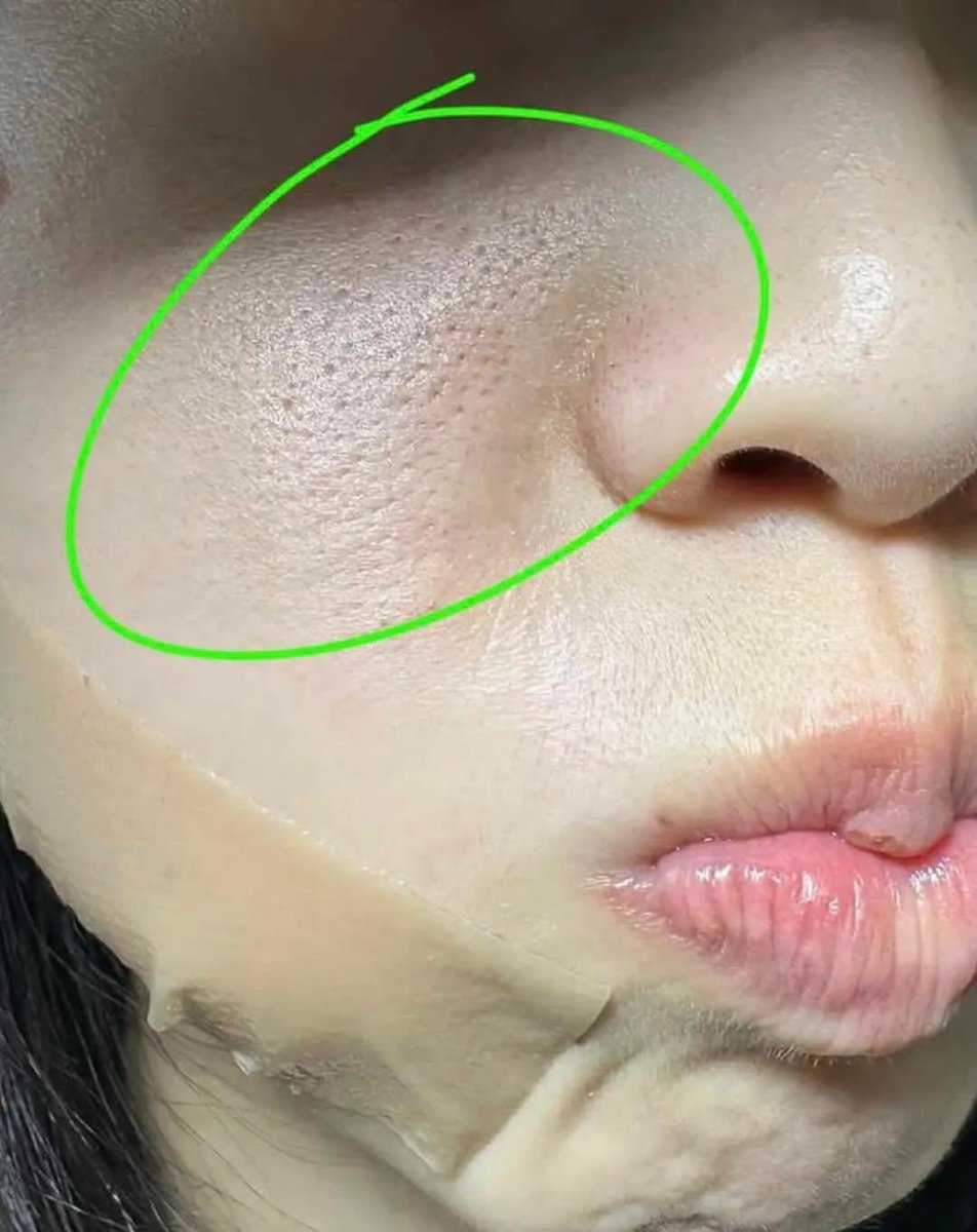 xurentpost's tweet photo. GA EKSPEK PRODUK INI BENER-BENER BIKIN MULUS MUKA JUGA 😍 https://t.co/CTzIpn8OU0