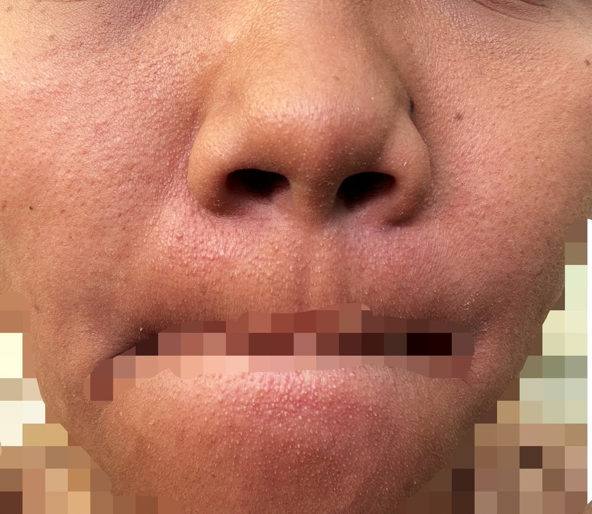 ohmy_beautybank's tweet photo. CW / TW : ZOOM MUKA

[BB] guys biar muka ini mulus gimana yaa selain treatment,  pakai apa please rekomendasiin produk yang cocok (no aff) butuh bgt soalnya, tolong jangan oot replynya. terimakasih 🙏 https://t.co/z5eGjX2E2B