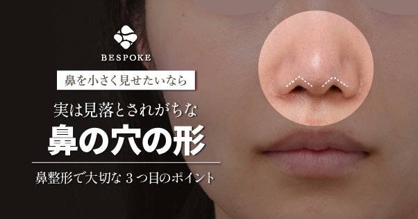bespoke_clinic's tweet photo. ＼新着コラム情報／
小鼻をただ小さくするだけではダメ？
「鼻の穴の形」の重要性を徹底解説！

🔗https://t.co/1anJ2kSUtV

・「鼻の穴の形」の重要性 
・小鼻を「小さくするだけ」はダメ？ 
・鼻の穴を調整する術式とは 
・ビスポークの鼻の穴の症例

など  ぜひご覧ください！ https://t.co/wwtd0ZkeOf