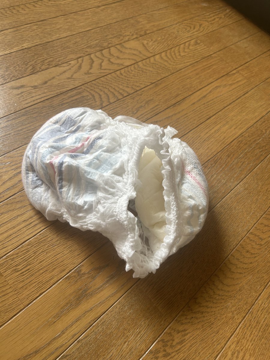 omomtarou's tweet photo. 今日の抜け殻
結構黄色い笑 https://t.co/laerPCPoFH