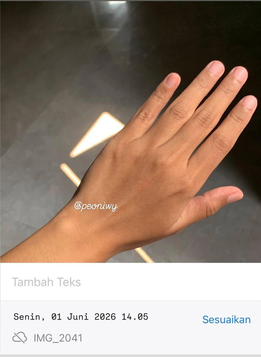 peoniwy's tweet photo. MAAF TAPI TIDAK TAHAN UNTUK TIDAK SHARE INI PADAHAL BARU 2X PEMAKAIAN🫵🏻😭🫶🏻
AKU SPILL BUKTI TANGGAL BEFORE-AFTERNYA YAA
FINALLY GLASS SKIN YANG AKU MAU TANPA SUNTIK SUNTIK‼️ https://t.co/U4XNhje4lU