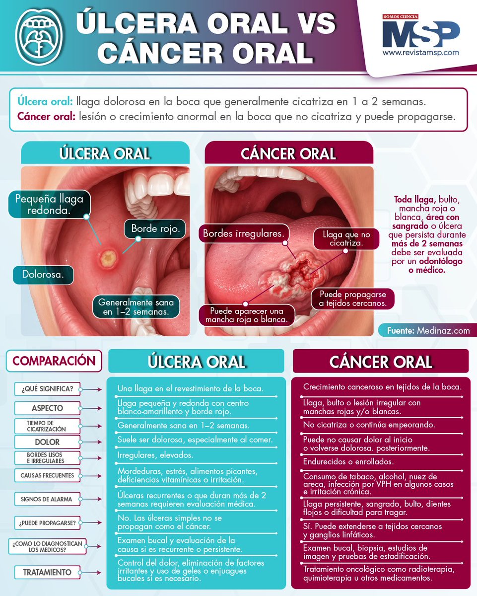 RevistaMSP's tweet photo. #MSPOncología 👄 Una úlcera oral suele sanar en 2 semanas; si persiste, sangra o cambia, podría ser una señal de alerta. Si dura más de 14 días o notas bultos y manchas, consulta a un profesional. Detectar a tiempo el cáncer oral salva vidas.
#SomosCiencia #LiderDigital https://t.co/zuhRw5Xd9j