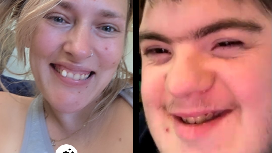 FollowillGirl95's tweet photo. @McJuggerNuggets So bc your unborn baby might have had a disability you did the moral thing and ripped his arms&amp;legs off, fractured his skull into pieces to pass through the cervix? Got it. Blessed, bc my nephew was given life &amp; he is PERFECT. you dont know true love until you love a baby w/ DS. https://t.co/5hUxG5qtmP