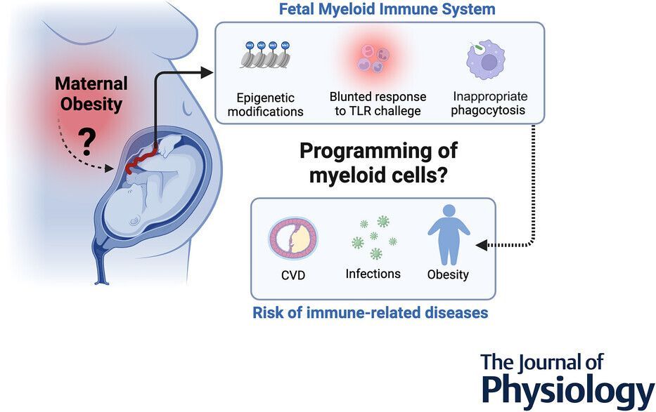 JPhysiol's tweet photo. In this review, Macarena Lépez (@FacMedicinaUC) and colleagues examine the impact of maternal #obesity on fetal #myeloid immune cells and explores potential mechanisms that underlie early-life immune programming 🔬 📜 

Read it here👇️ 
https://t.co/2Ke4tMlbP4 https://t.co/3YWWyVk7b5