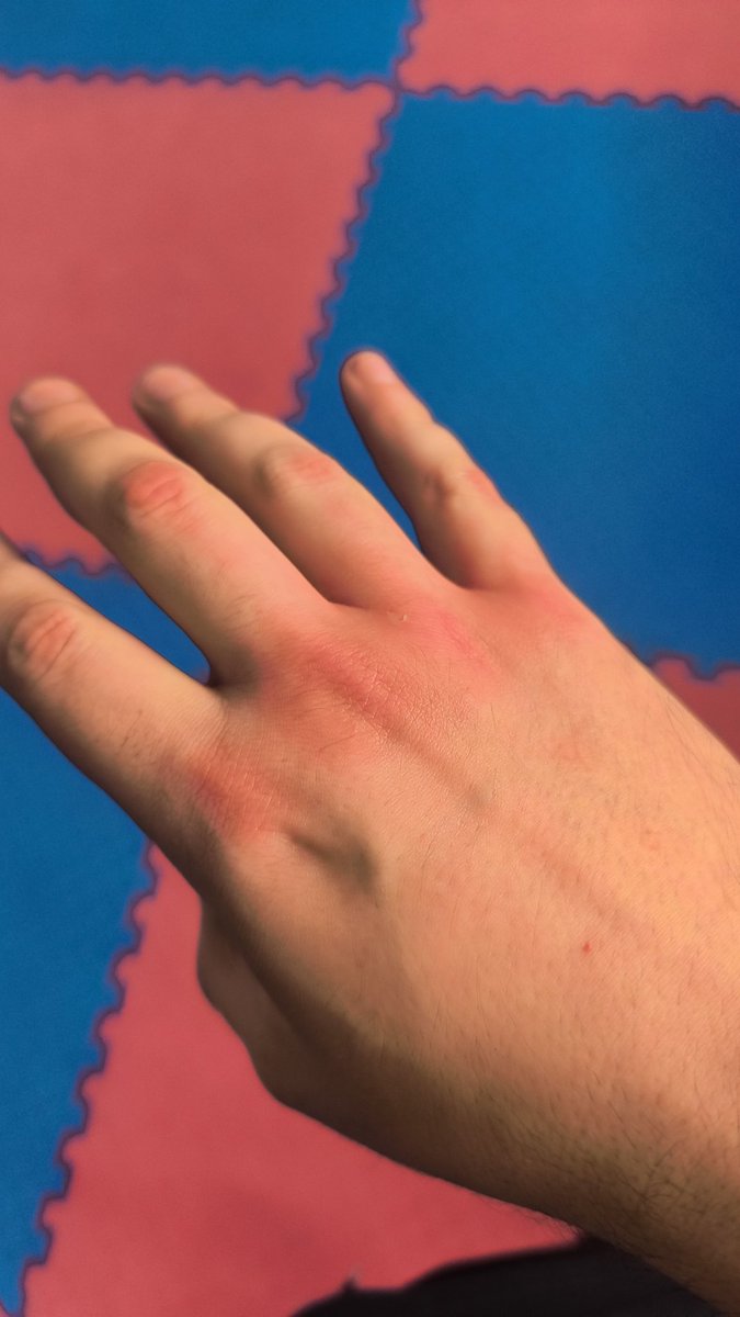SimonBrandR's tweet photo. Toca volver a sacar callo en los nudillos que llevo unos meses que me pego poco. Asi que un poco de golpeo post pierna y a funcionar. https://t.co/OiwpMviMnO