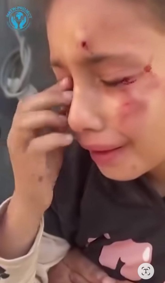 HugoMS4's tweet photo. @antonioguterres @UN I agree! The United States/Israeli Terrorist &amp; Genocidal Alliance is responsible for most of the suffering globally. Especially &amp; directly in Gaza, the West Bank, Lebanon, Iran, Cuba, &amp; Venezuela. As a citizen of the United States, I want to see Iran win. @araghchi @gideonle @AOC https://t.co/2x0nWzniCL