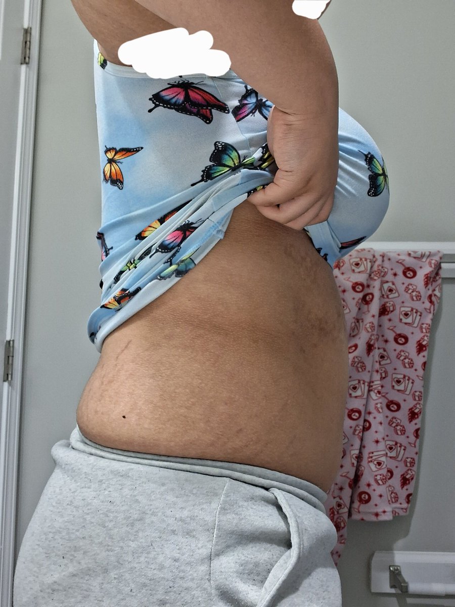 BenzanIsab14957's tweet photo. Do we see a difference?? #fat #fatspo #ana #ed #edtwt https://t.co/QhTcOnzJqP