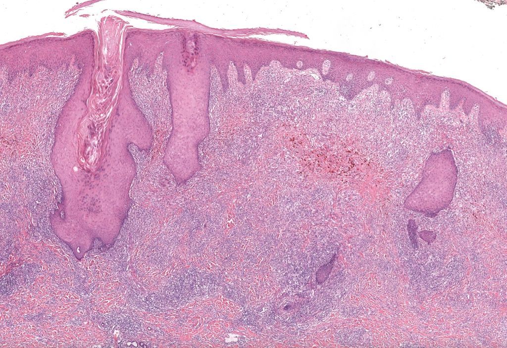 JMGardnerMD tweet picture