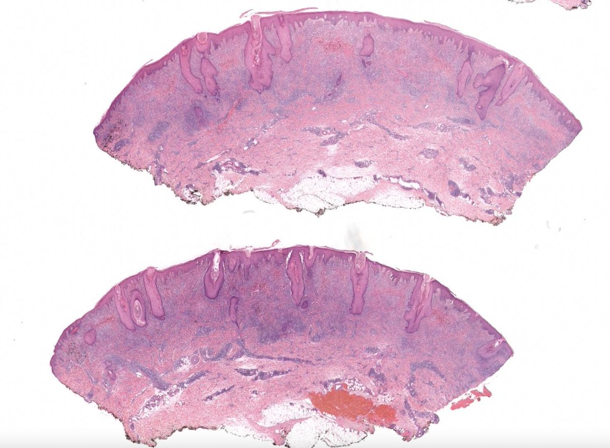 JMGardnerMD tweet picture