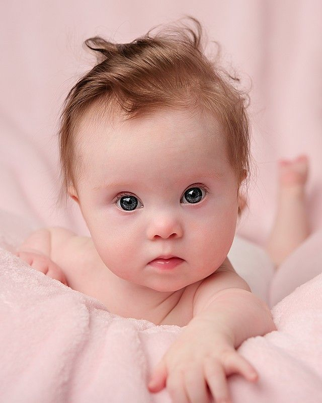 LifeNewsHQ's tweet photo. This baby with Down Syndrome is valuable and worthy of life. https://t.co/HabMJrKjc9