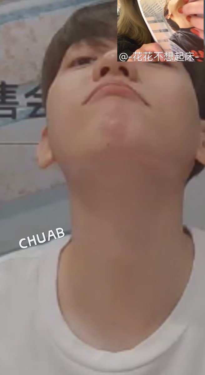 92outro's tweet photo. baekhyun’s reaction after a fan said his chin mole is sexy https://t.co/dr3Bq5qSg7